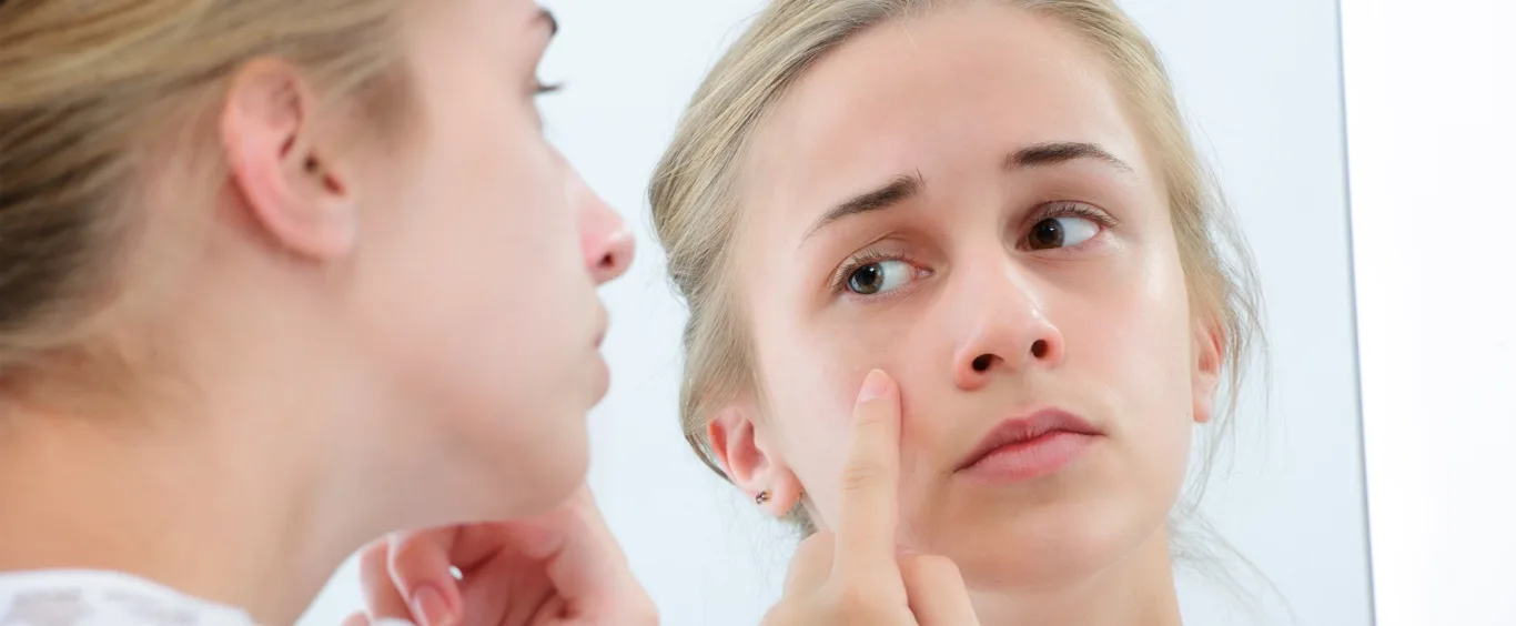 About Skin Cancer