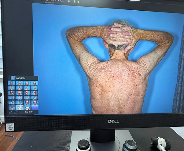 Follow-Up & Biopsy Protocols